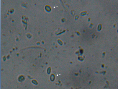 nosema spores