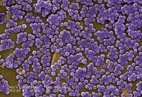Staphylococcus aureus