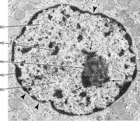 nucleolus electron micrograph